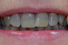 Before