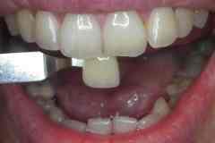 Before