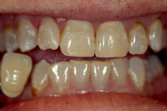 Before