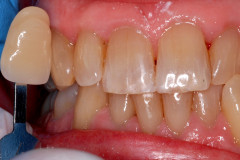 Before
