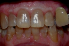 Before