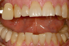 Before