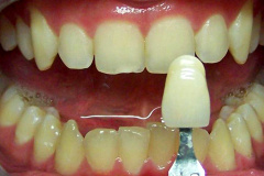 Before