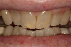 Before