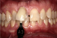 Before