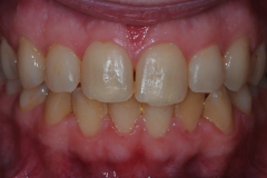 Before