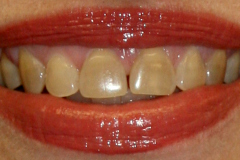 Before