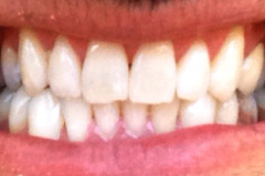 After
