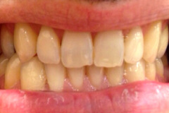 Before