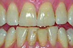 Before