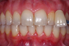 Before