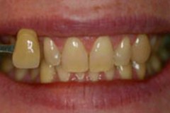 Before