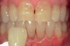 Before