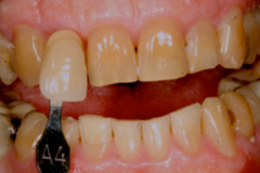 Before