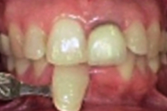 Before