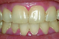 Before