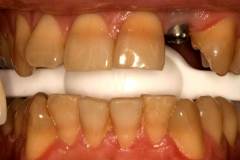Before