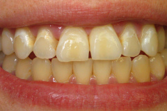 Before