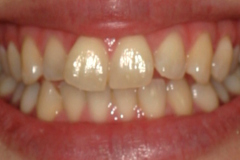 Before