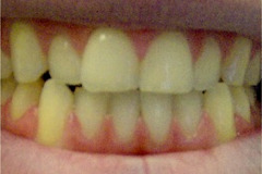 Before