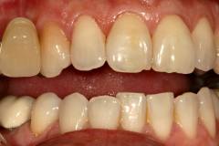 Before
