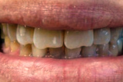 Before