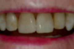 Before