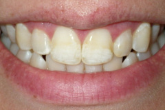 Before