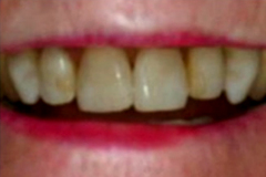 Before