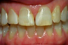 Before