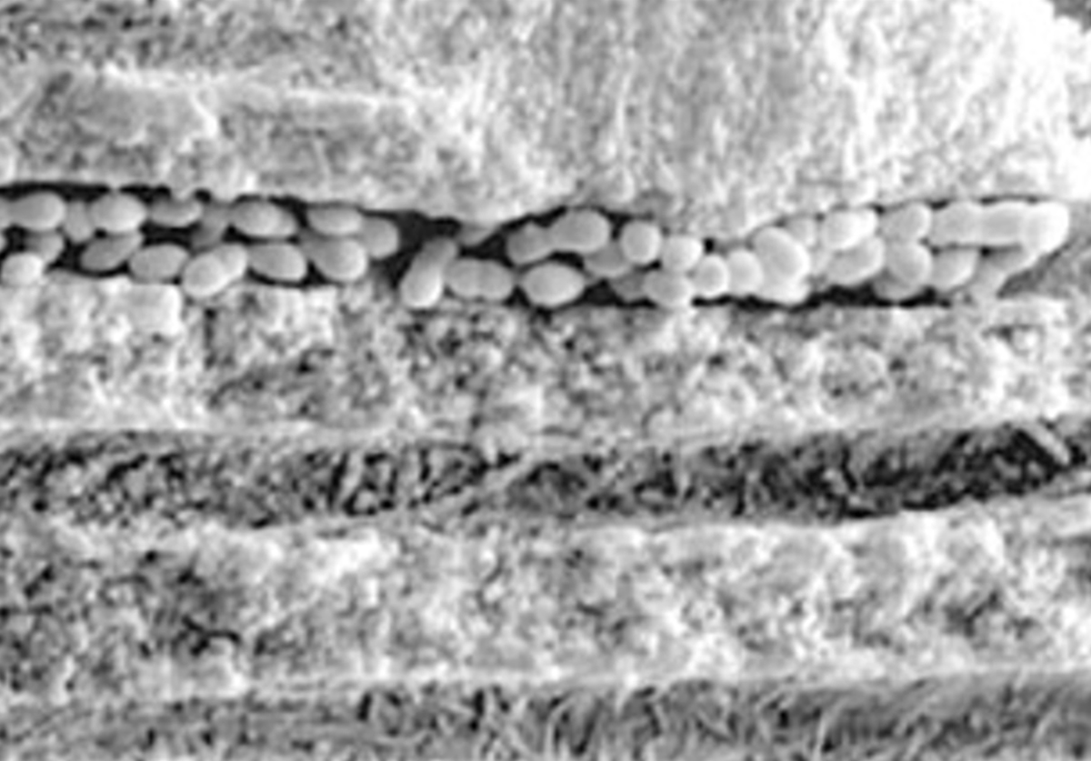Bacteria in tubules1-a