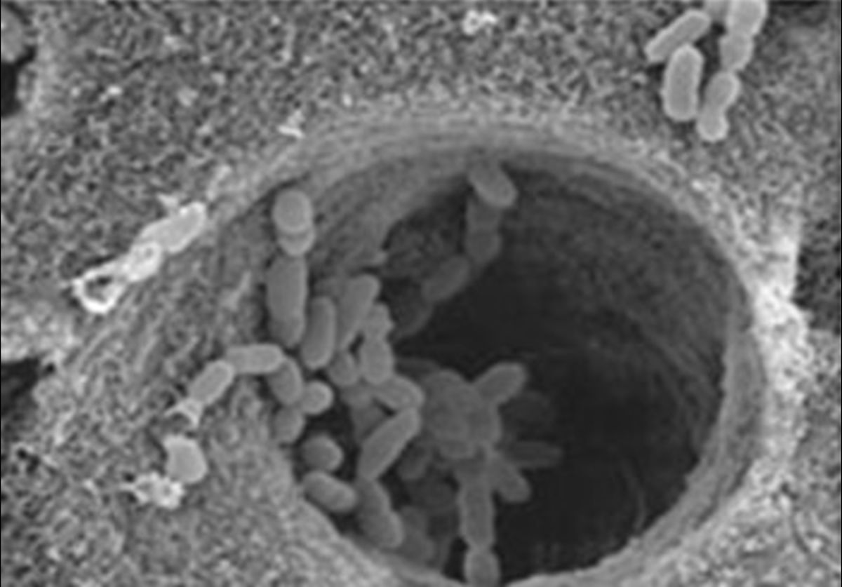 Bacteria in tubules2-a