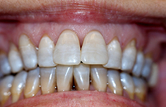 alina-after-image-new